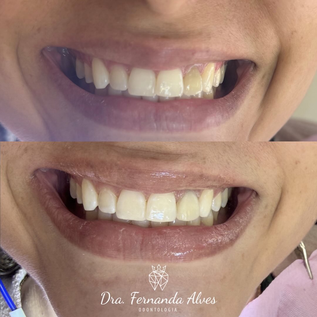 Correção de Formato e Cor (antes e depois)